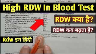 Rdw blood test hindi  High RDW In Blood Test  Rdw test means  Rdw test report [upl. by Hakilam]