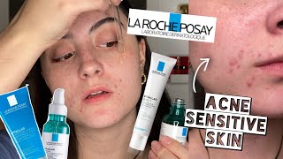 TESTING LA ROCHE POSAY EFFECLAR SKINCARE ROUTINE ON ACNE SENSITIVE DRY SKIN FOR 2 WEEKS [upl. by Yliab]