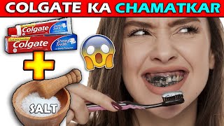 Colgate Funny Ads compilation  COLGATE ka Chamatkar  toothpaste Roasting [upl. by Alcot]