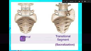 Lumbar Spine Anatomy [upl. by Lyndes]