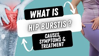 HIP BURSITIS IS OVERDIAGNOSED  WHY YOUR HIP PAIN MIGHT NOT BE WHAT YOU THINK [upl. by Lorena626]