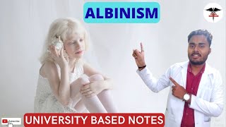 ALBINISM  clinical manifestations  Laboratory findings  treatment [upl. by Quickman]