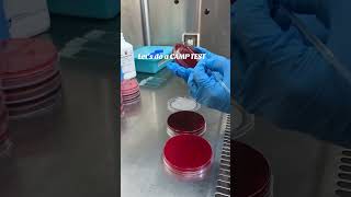 CAMP test for Streptococcus agalactiae  GBS and Listeria Microbiology [upl. by Neitsabes384]