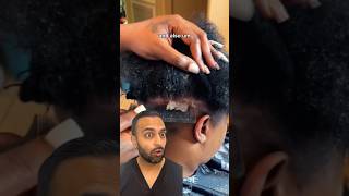 The Importance Of Treating Scalp Psoriasis  Dr Somji Explains [upl. by Brezin482]