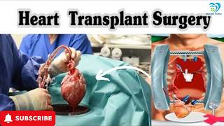 How does Heart transplant surgery work 3danimation heartsurgery [upl. by Blynn653]