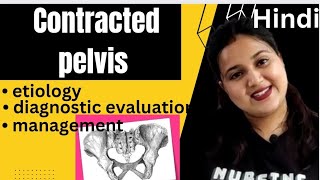 Contracted pelvis etiology Robert pelvis  Naegles pelvis  diagnosis management Hindi [upl. by Akimik623]