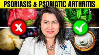 8 WORST Foods for Psoriasis And Psoriatic Arthritis [upl. by Styles]