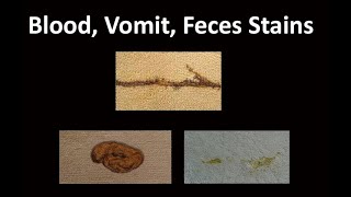 How to Remove Blood Vomit and Feces from Carpet is excerpted from a BaneClene® training seminar [upl. by Anaiuq573]