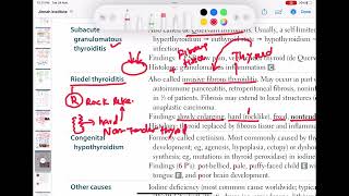 Riedel thyroiditis endocrinology 41  First Aid USMLE Step 1 in UrduHindi [upl. by Aicilaana51]