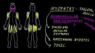 Myopathy and neuromuscular junctionopathy [upl. by Clemente]