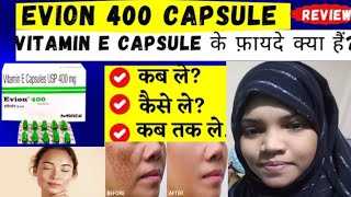 vitamin e capsules evion 400 capsules for face pigmentation pimples ko kese thik karta hai [upl. by Macur498]