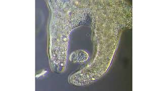 nutrition in amoeba  real under microscopic view  digestion absorption  excretion [upl. by Akir]