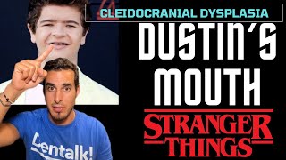 STRANGER THINGS  The rare disease that affects Dustin’s teeth  Cleidocranial Dysplasia [upl. by Benjy]