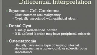 Fibrosarcoma [upl. by Amrac]