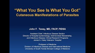 Cutaneous Manifestations of Parasites John Toney MD [upl. by Adnol]