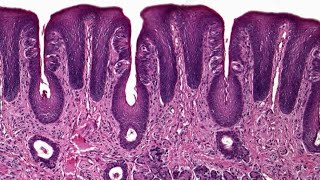 Circumvallate papillae  practical Histology [upl. by Llemert]