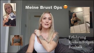 ALLES über meine Brustvergrößerung 😍 Erfahrung vorhernachher Fotos RisikenFolgen Preise etc [upl. by East]