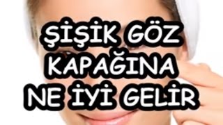 ŞİŞİK GÖZ KAPAĞINA NE İYİ GELİR [upl. by Daj]