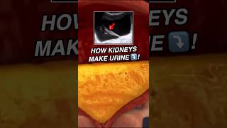 Doctor explains URETERAL JET 💛🛩️💦 sciencefacts [upl. by Acinemod]