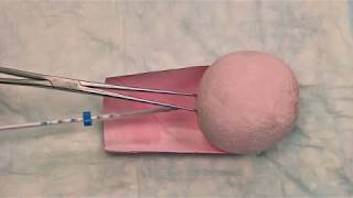 Hormonal IUD LNGIUS Insertion Technique [upl. by Horner]