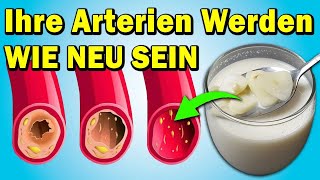 Reinigen Sie in 7 Tagen Ihre Arterien und entfernen Sie schlechtes Cholesterin mit diesem Rezept [upl. by Yevi31]