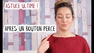 2 produits INCONTOURNABLES pour faire CICATRISER son BOUTON après l’avoir percé [upl. by Fairbanks749]