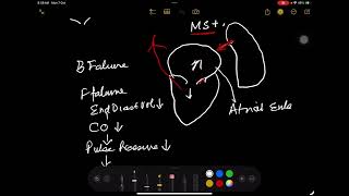 Endocardial Cardiac Defects GKSingh PIMS [upl. by Elwee]