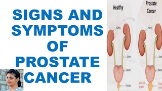 ସାବଧାନଦେଖିନିଅନ୍ତୁ ଏହି ଲକ୍ଷଣODIA HEALTH TIPSODIA HOME REMEDIESSYMPTOMS OF PROSTATE CANCERSIGNS [upl. by Harpole460]