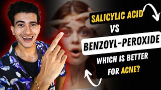 Benzoyl Peroxide vs Salicylic acid For Acne  Benzoyl Peroxide  Salicylic Acid [upl. by Tamanaha]