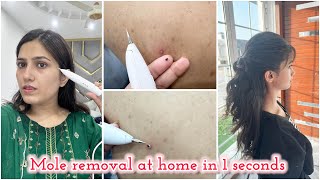 i Remove My Moles amp Wart in 1 sec at home  Mole amp Wart remover pen [upl. by Ina]