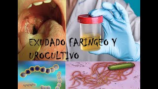 Exudado faríngeo y Urocultivo en Laboratorio [upl. by Dragoon]