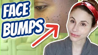 How to get rid of bumps on the face Dr Dray [upl. by Blockus]