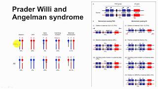 72 Impriting and Imprinting Disorders  Prader Willi and Angelman Syndroes [upl. by Longan718]