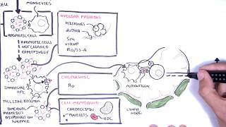 Systemic Lupus Erythematosus SLE  signs and symptoms pathophysiology investigations treatment [upl. by Tlaw]