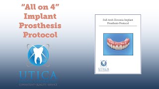 quotAll on 4quot Full Zirconia Arch Procedure Protocol [upl. by Anehs493]