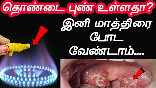 என் பாட்டி கை வைத்தியத்தால் எனக்கு சரியானது  thondai pun maruthuvam  Throat Pain  thondai vali [upl. by Balsam570]