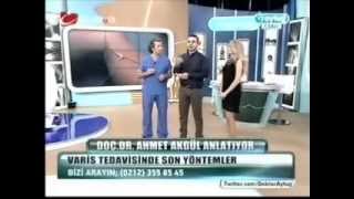 DVT  Varis damarı tıkanıklığı  tedavisi  Prof Dr Ahmet AKGÜL [upl. by Sarena]