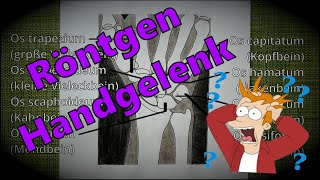 Röntgen Handgelenk in 2 Ebenen  Stecher [upl. by Ericha]