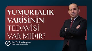 Yumurtalık Varisinin Tedavisi Var Mıdır [upl. by Nolad]