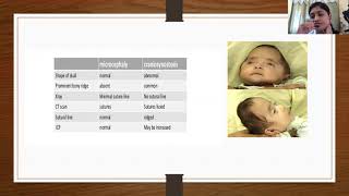 Microcephaly and Macrocephaly  Dr Deblina [upl. by Bunce]