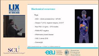 Recaída bioquímica en el cancer de próstata Urología oncológica Medellin Colombia [upl. by Aivatnohs]