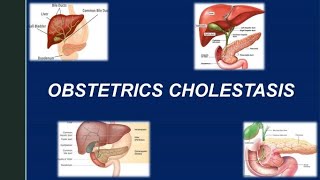 Obstetric Cholestasis RCOG Guideline [upl. by Cattima]