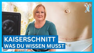 Gynäkologin erklärt Kaiserschnitt  Ablauf Narbe amp Heilung – Was du wissen musst [upl. by Amoreta]