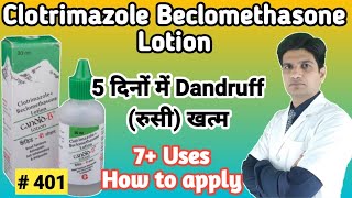 Candid B lotion  Candid B lotion for hair dandruff  Clotrimazole beclomethasone lotion [upl. by Baoj798]