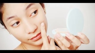 How to remove acne scars [upl. by Havener]