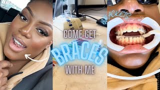 come with me to get braces  vlog [upl. by Lhok]