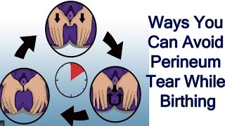 Ways You Can Avoid A Perineum Tear While Birthing SheCare [upl. by Gnehc]