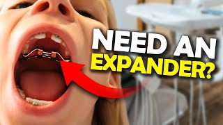 Getting a Palatal Expander What you NEED to know  McKinney Orthodontist [upl. by Patten]