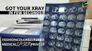 Medical Laser Printer for x ray ultrasound radiography printing [upl. by Sweyn]