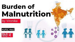 Burden of MALNUTRITION in under 5 children The Lancet Child amp Adolescent Health report UPSC IAS [upl. by Toffey]